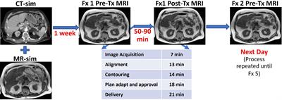 Impact of intrafraction motion in pancreatic cancer treatments with MR-guided adaptive radiation therapy